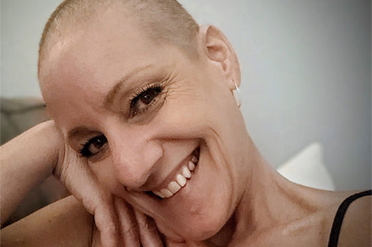 Michelle Thompson's Alopecia Journey