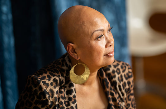 Shining A Light On Alopecia Awareness Month