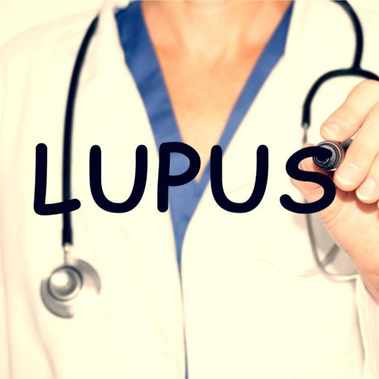 Can Lupus Cause Hair Loss?